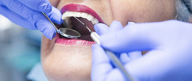 Best Chipped Tooth Repair Near Me  in Avon Lake, OH